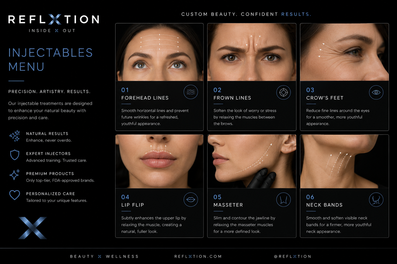 REFL✕TION Injectables Menu — Forehead Lines, Frown Lines, Crow's Feet, Lip Flip, Masseter, Neck Bands